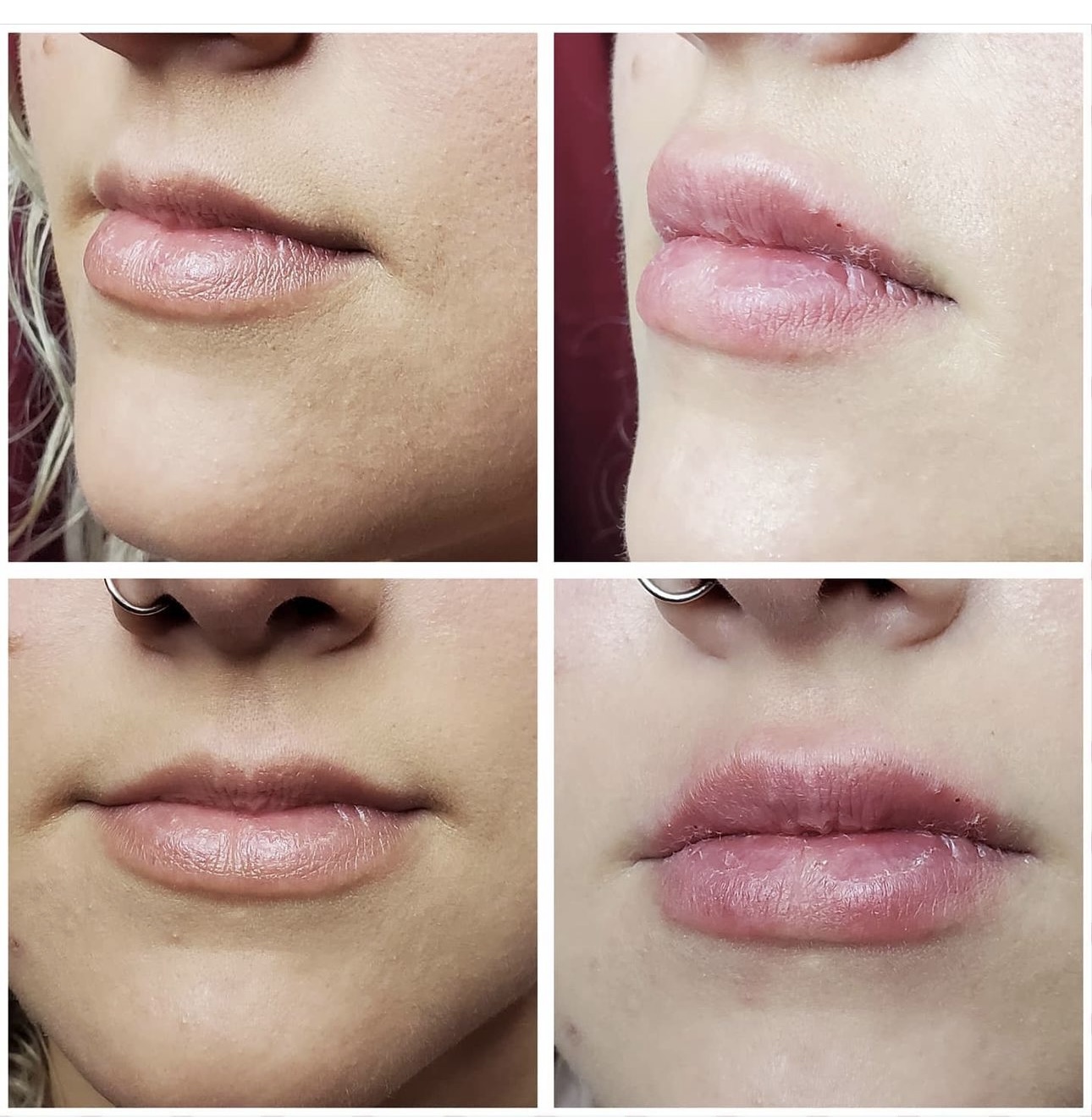 Before and after cosmetic treatment results